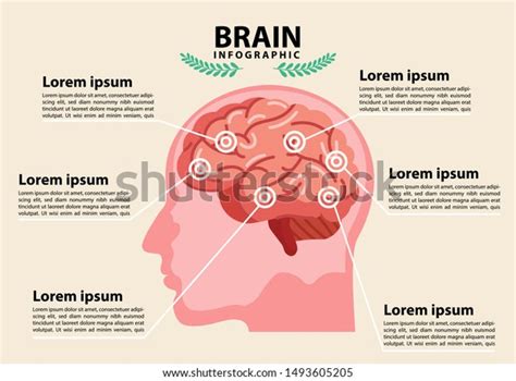 Scientific Medical Illustration Human Brain Stroke Stock Vector