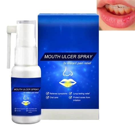 Ulcer Breath Sprays Oral Ulcer Sprays Oral Care Spray Canker Relief Spray Mouth Ulcer Sprays Dry