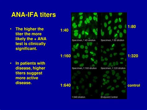 Ppt Choosing The Correct Ana Technology For Your Laboratory