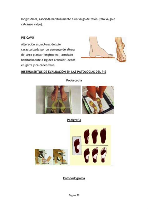 PDF 7 Fundamentos de la biomecánica del aparato locomotor DOKUMEN TIPS