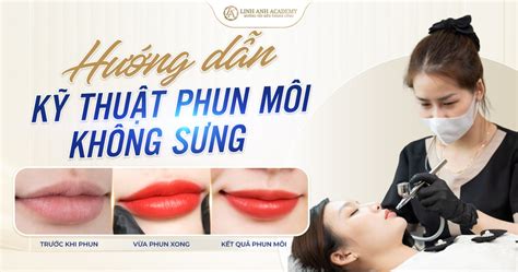 Nguyên Nhân Và Cách điều Trị Các Vấn đề Về Phun Môi Sưng