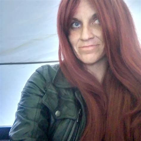 Why a cist of this type can appear without any warning 3