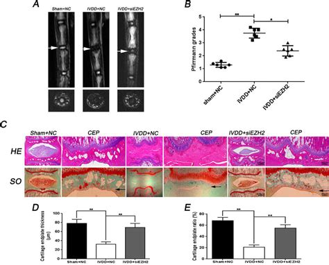 Inhibition Of Ezh2 Ameliorates Cep And Disc Degeneration In Rat Ivdd