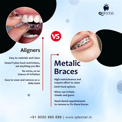 Discover Your Perfect Smile Braces Vs Aligners Dental Posts