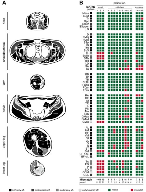 Established Pattern Of Muscular Affection In Matr Associated Distal