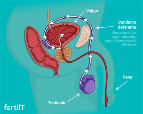 Eyaculaci N Retr Grada Qu Es Consecuencias Y Tratamiento