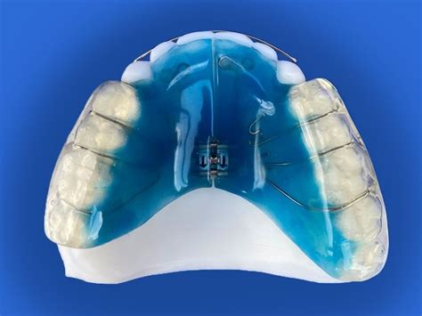 Orthodontic Appliances For Development Cd Ortho Studio