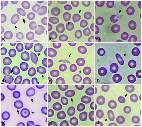 Burr Cells