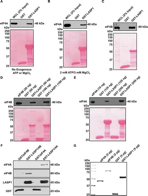 Frontiers The Cxcr Lasp Eif F Axis Promotes Translation Of