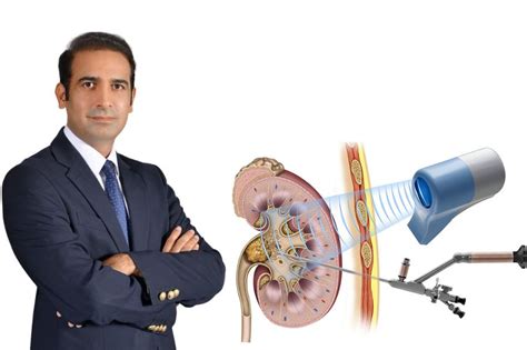 Kidney Stone Laser Treatment in Lahore Pakistan - Dr. Abdul Rauf