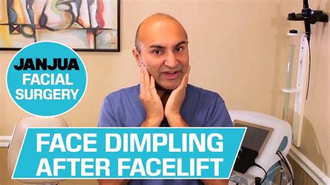 Facial Dimpling After Facelift 59 Plus 1 Dr Tanveer Janjua Youtube