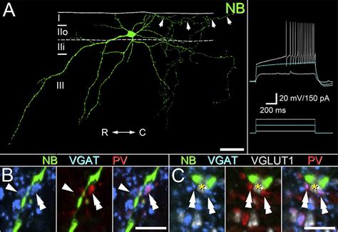 Pv Interneurons Are A Source Of Inhibitory Inputs To The Dendrites Of