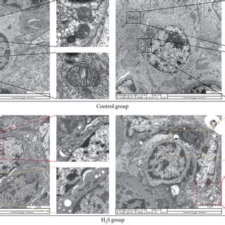 Histopathological And Ultrastructural Changes In Chicken Spleens