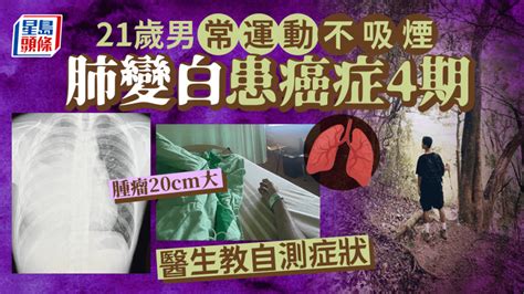 癌症症狀｜21歲男常運動不吸煙 胸痛揭肺變白患癌症4期 醫生教自測症狀