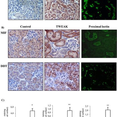 Cd74 Localization To Perinuclear And Cell Membrane Areas In Distal