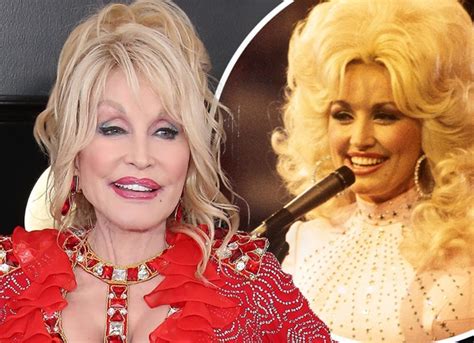 Dolly Parton Plastic Surgery: Her $1Million Appearance