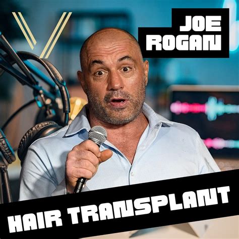 Joe Rogan Hair Transplant: Before and After Transformation