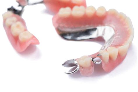 Dentures In Browns Plains Choice Dental