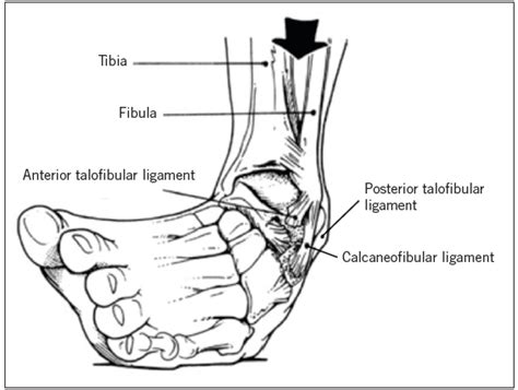 The Weekend Athlete Common Foot And Ankle Injuries Consultant360