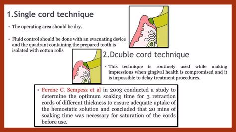 Gingival Retractionpptx