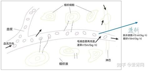 透析好不好？准确评估脱水量才能透的更长久！ 知乎