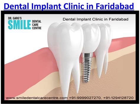 Visit To Get Best Dental Implant Clinic In Faridabad By