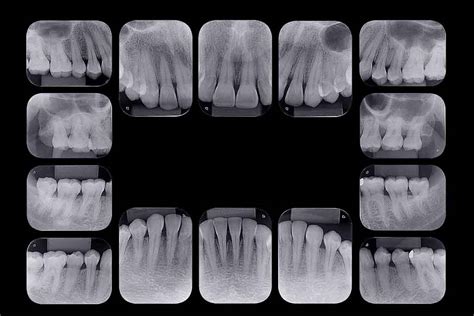 Radiografias OdontoPixel