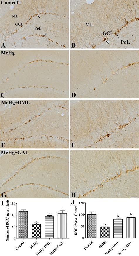 Immunohistochemistry For Doublecortin Dcx In The Dentate Gyrus Of The