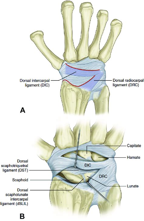 A The Window Approach To The Carpus Preserves All Dorsal Ligament