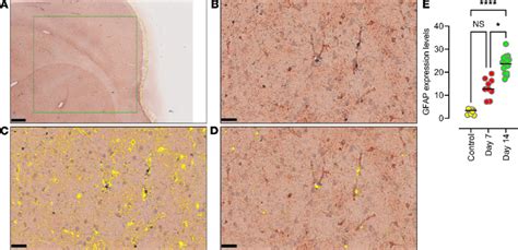 Quantitative Determination Of Gfap And Iba 1 Expression Using Tissue