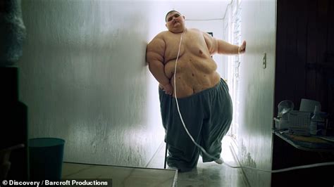 The world's former fattest man at 93st has life-saving surgery | Daily Mail Online