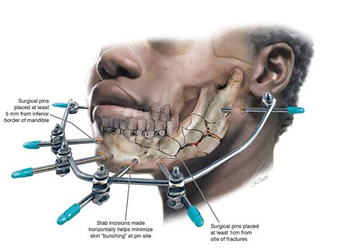 Injury Illustration Spotlight Artists Blogs Medical Illustration