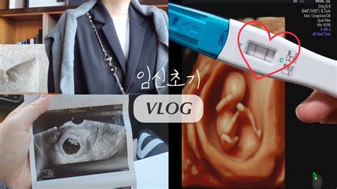 임신vlog 임신초기 6~17주 일상ㅣ짧은 입덧기간 먹은 음식들ㅣ초기 초음파기록ㅣ젤리곰부터 성별확인까지👶🏻💕 Youtube