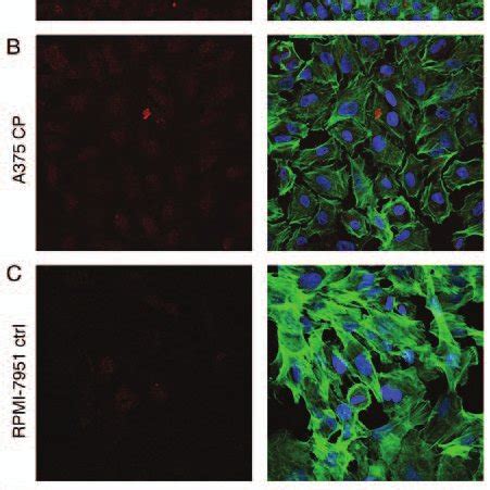 Apoptosis Analysis Of Melanoma Cell Lines A375 And RPMI 7951 A