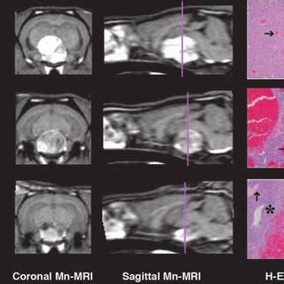 Mn Mr Images Of Individual Subjects Show Correspondence To H E Stain