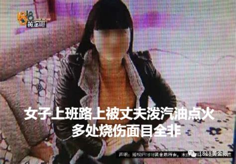 女子上班路上被丈夫潑汽油點火 多處燒傷面目全非 Peekme