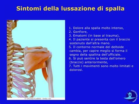 Lussazione Della Spalla I Sintomi Le Complicanze E Gli Esami Pi Utili