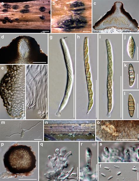 Leptosphaeria Cichorium Facesoffungi Number FoF 01156 Faces Of Fungi