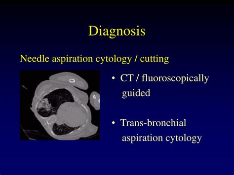 Ppt Common Thoracic Procedures Powerpoint Presentation Free Download