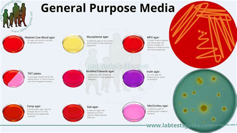 Types Of Culture Media Differential Selective And 42 Off