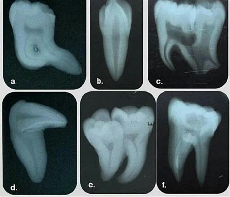 Pin by Amy Izquierdo on Odontología Dental assistant Dental