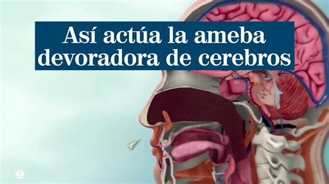 As Act A La Ameba Devoradora De Cerebros Youtube