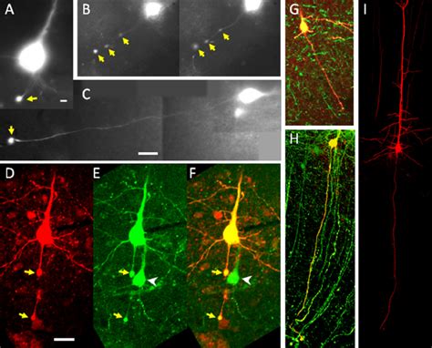 Identification Of Axotomized And Intact Yfp Layer V Pyramidal