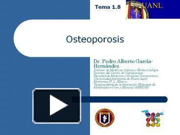 Ppt Tema Osteoporosis Dr Pedro Alberto Garc A Hern Ndez