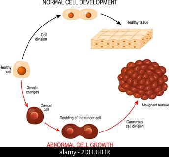 Cancer Cell Illustration Showing Cancer Disease Development Vector