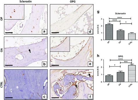 Sclerostin And Opg Expression Immunohistochemistry Results Were