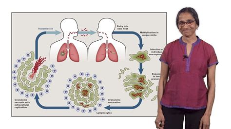 Lalita Ramakrishnan Cambridge Tuberculosis The Pathogenic