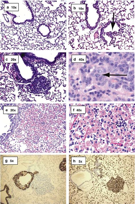 Cc Cre Lsl K Ras G D Mice Display Lung Tumorigenesis Normal Airway