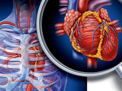 Enfermedades Cardiovasculares Mind Map