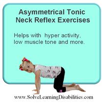 Retained Asymmetrical Tonic Neck Reflex (ATNR) - Solve Learning ...